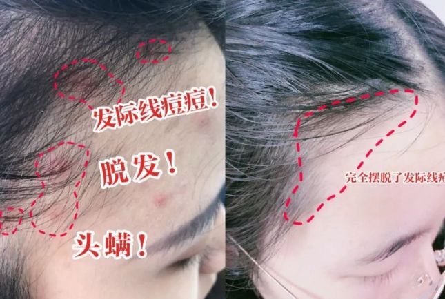 好？10分钟轻松养成女明星「绸缎发」冰球突破平台洗完头自然风干还是吹干(图19)